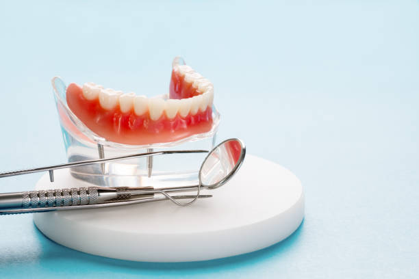 Dental Inlays and Onlays in Methuen Town, MA